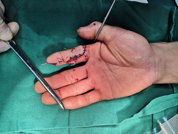 微信圖片_20210323111106 微信圖片_20210323111106